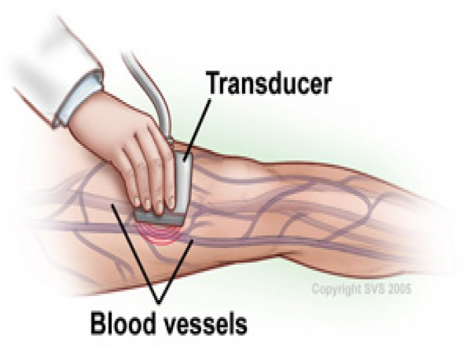 leg-doppler-scan