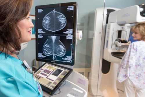 mammography