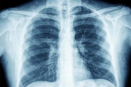 radiology