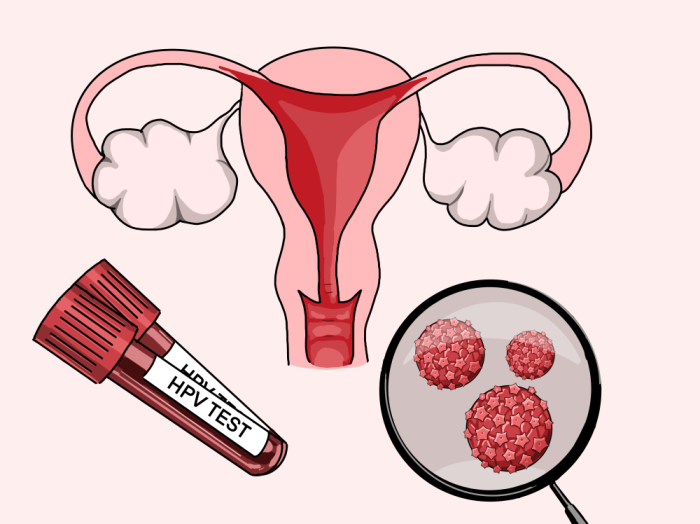 HPV