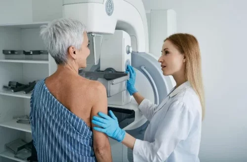Mammography