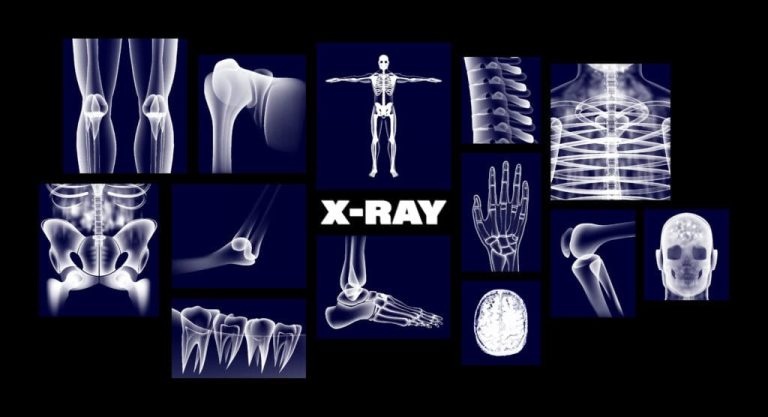 x ray